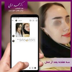 جراحی-بینی-کاشان-95