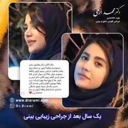 جراحی-بینی-225