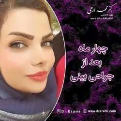 جراحی-بینی-226