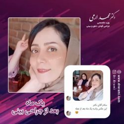 جراحی-بینی-235