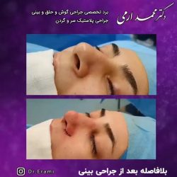 جراحی-بینی-247