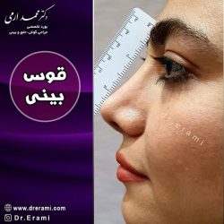 جراحی-بینی-271