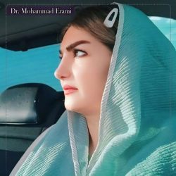 Rhinoplasty-342