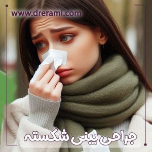 جراحی بینی شکسته در کاشان - دکتر محمد ارمی