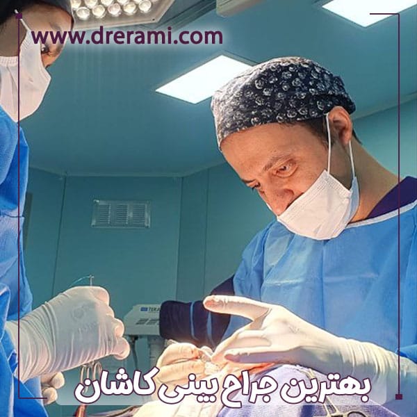 جراح بینی کاشان - دکتر محمد ارمی