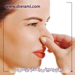 بوی بد بینی بعد از جراحی _ دکتر محمد ارمی