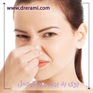 بوی بد بینی بعد از جراحی - دکتر محمد ارمی