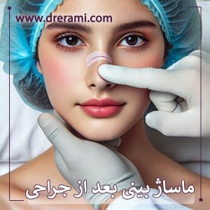 ماساژ بینی بعد از جراحی _ دکتر محمد ارمی
