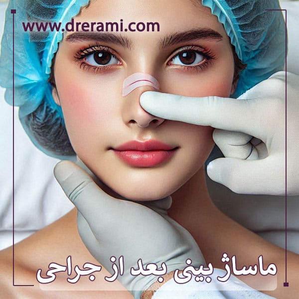 ماساژ بینی بعد از جراحی _ دکتر محمد ارمی