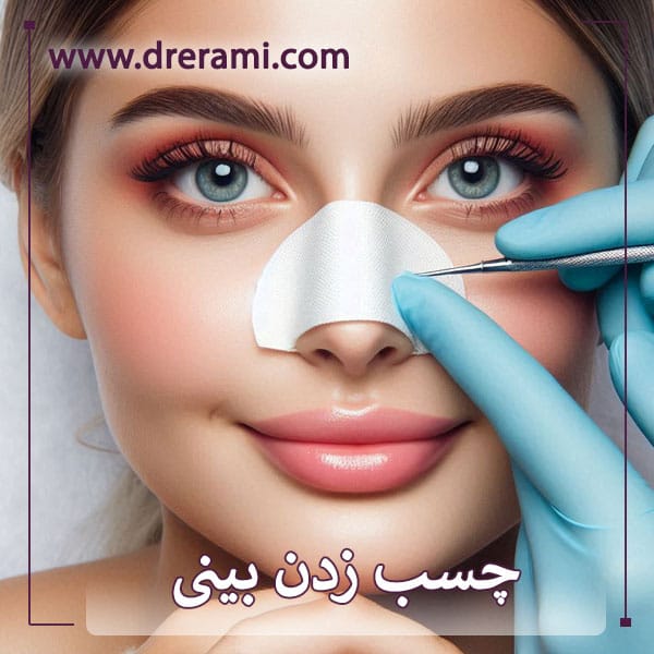 چسب زدن بینی بعد از عمل _ دکتر محمد ارمی