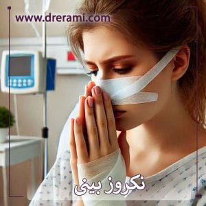 نکروز بینی _ دکتر محمد ارمی