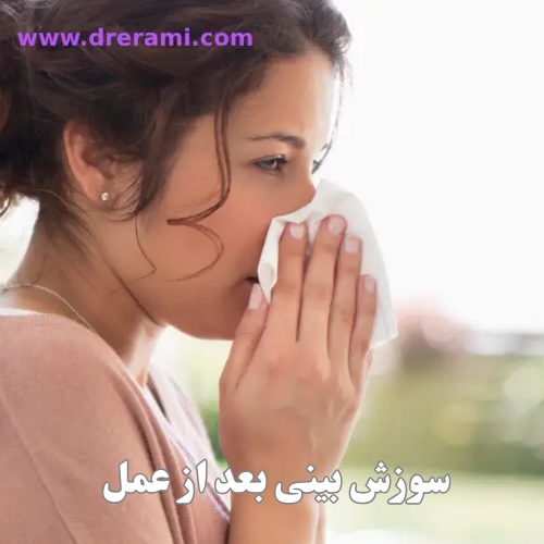 سوزش بینی بعد از عمل _ دکتر محمد ارمی