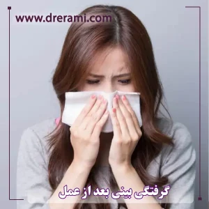 کیپ شدن بینی بعد از عمل _ دکتر محمد ارمی