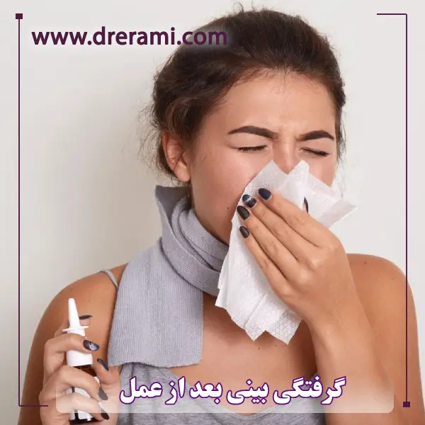 گرفتگی بینی بعد از عمل _ دکتر محمد ارمی
