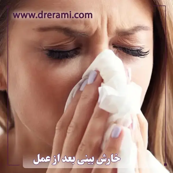 خارش بینی بعد از عمل _ دکتر محمد ارمی