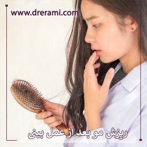 درمان ریزش مو بعد از جراحی بینی _ دکتر محمد ارمی