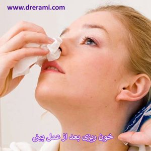 خون ریزی بعد از عمل بینی _ دکتر محمد ارمی