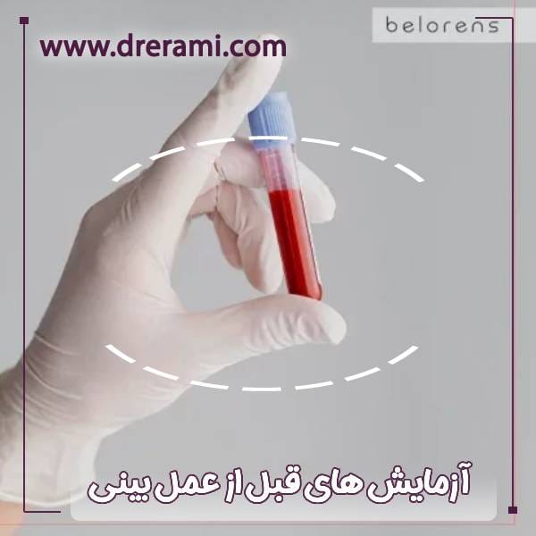 آزمایش های قبل از جراحی بینی