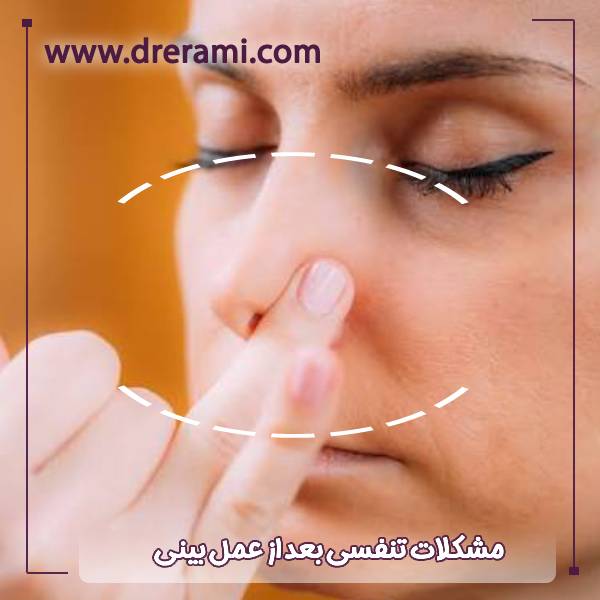 مشکلات تنفسی بعد از جراحی بینی